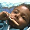 Boy With Laughing Seizures Undergoes Surgery To Get Rid Of Giggles